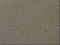 Testechiniscus laterculus image