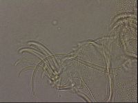 Testechiniscus laterculus image