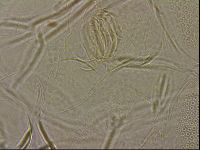Testechiniscus laterculus image