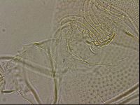 Testechiniscus laterculus image