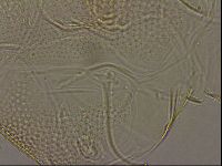 Testechiniscus laterculus image