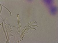 Testechiniscus laterculus image
