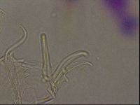 Testechiniscus laterculus image