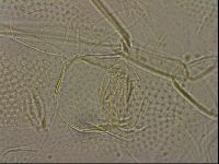 Testechiniscus laterculus image