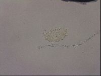 Testechiniscus laterculus image