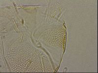 Testechiniscus laterculus image