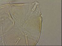 Testechiniscus laterculus image