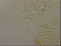 Testechiniscus laterculus image