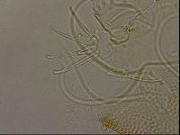 Testechiniscus laterculus image