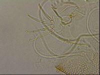 Testechiniscus laterculus image