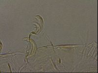 Testechiniscus laterculus image