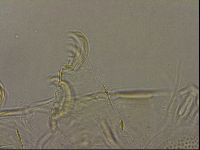 Testechiniscus laterculus image