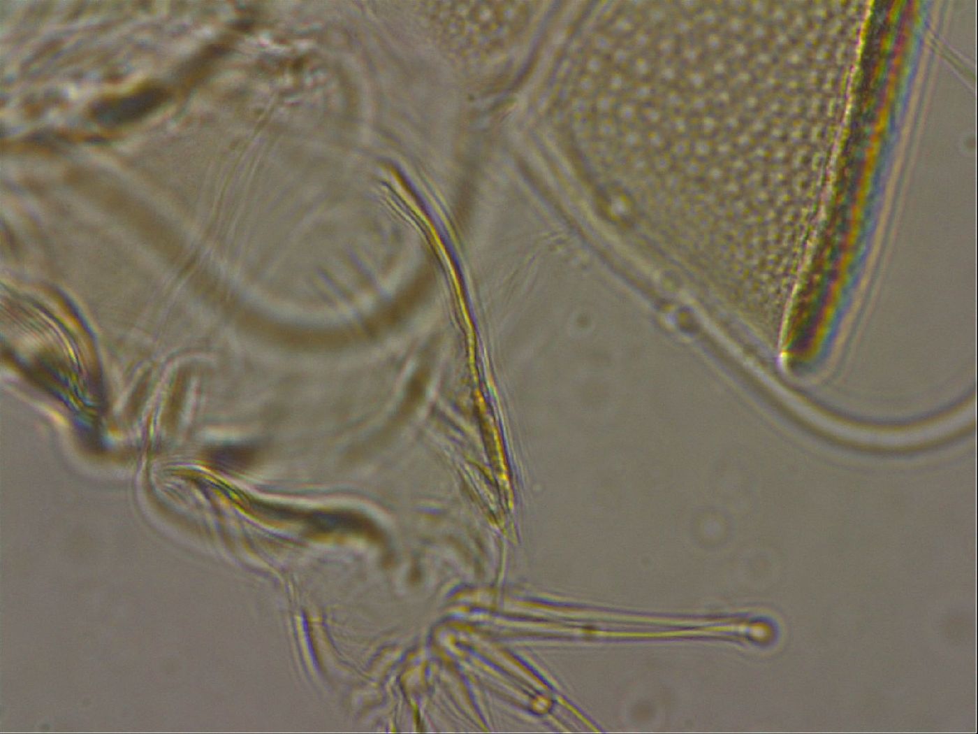 Testechiniscus laterculus image