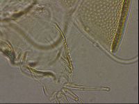 Testechiniscus laterculus image