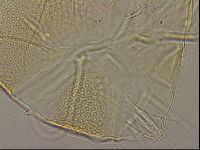 Testechiniscus laterculus image