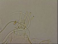 Testechiniscus laterculus image