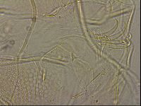 Testechiniscus laterculus image