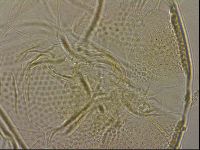 Testechiniscus laterculus image
