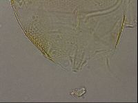 Testechiniscus laterculus image