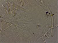 Testechiniscus laterculus image