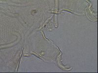 Testechiniscus laterculus image