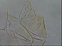 Testechiniscus laterculus image