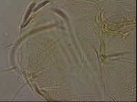 Testechiniscus laterculus image