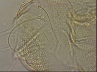 Testechiniscus laterculus image