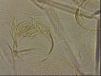 Testechiniscus laterculus image