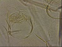 Testechiniscus laterculus image