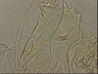 Testechiniscus laterculus image