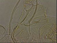 Testechiniscus laterculus image