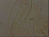 Testechiniscus laterculus image