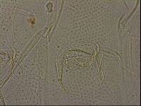 Testechiniscus laterculus image