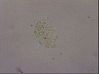 Testechiniscus laterculus image