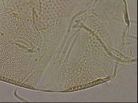 Testechiniscus laterculus image