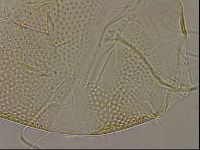Testechiniscus laterculus image