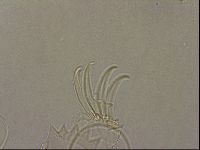 Testechiniscus laterculus image