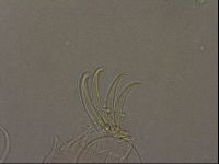 Testechiniscus laterculus image