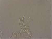 Testechiniscus laterculus image