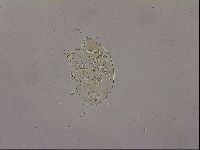 Testechiniscus laterculus image