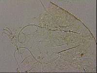 Testechiniscus laterculus image