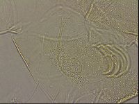 Testechiniscus laterculus image
