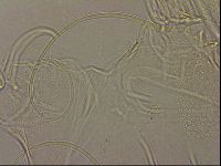 Testechiniscus laterculus image