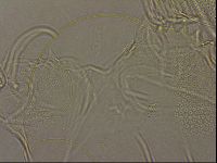 Testechiniscus laterculus image