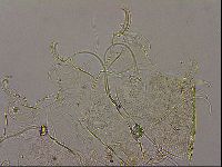Testechiniscus laterculus image
