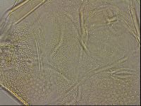 Testechiniscus laterculus image