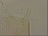 Testechiniscus laterculus image
