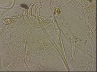 Testechiniscus laterculus image