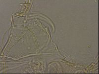 Testechiniscus laterculus image